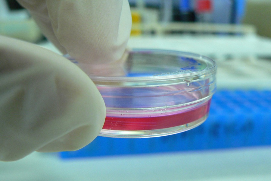 Petri dish culture